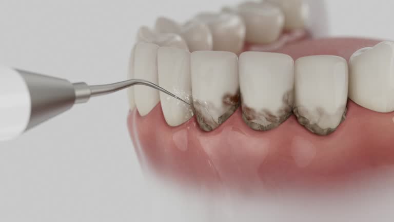 Reliable Dental contractor in Bridgeport, TX by Smile Center Dentistry